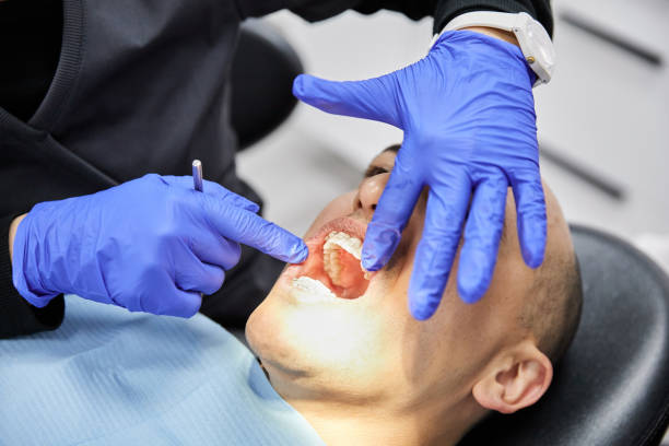 Best Emergency Dental Care for Sports Injuries in Maple Park, IL